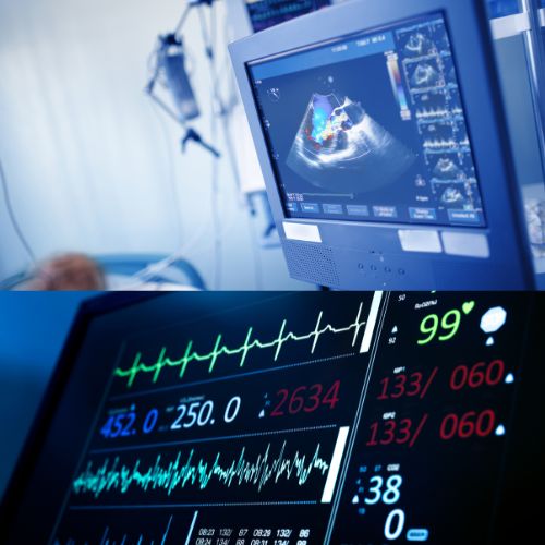 ECG & 2D Echo: These tests assess heart function and detect abnormalities using electrical and ultrasound imaging.