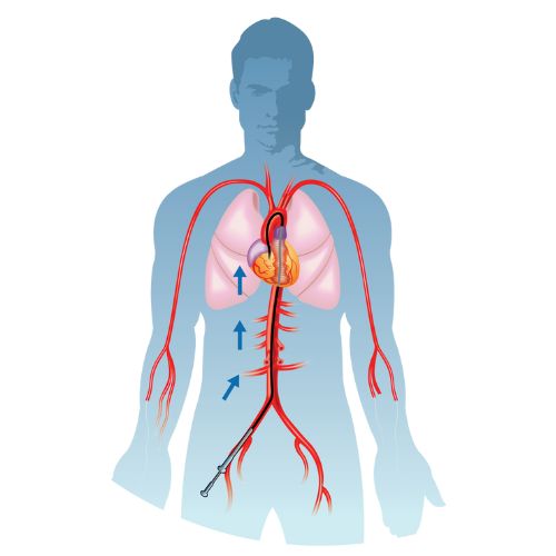 Coronary Angiography: Invasive procedure visualizing blood flow in heart arteries, crucial for diagnosing blockages and planning treatments.